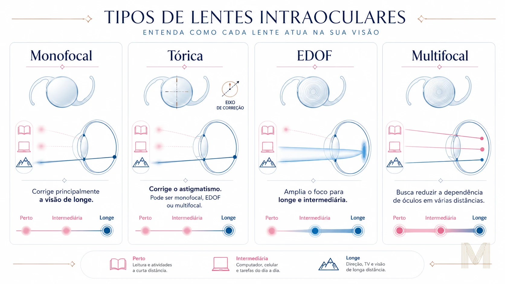 Comparação entre lentes intraoculares monofocal, tórica, EDOF e multifocal